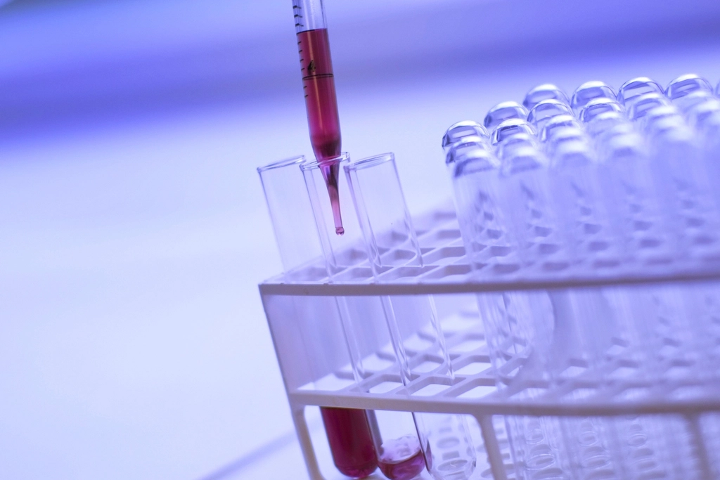 In the UK, A Blood Test Can Uncover Your Alzheimer’s Disease Risk