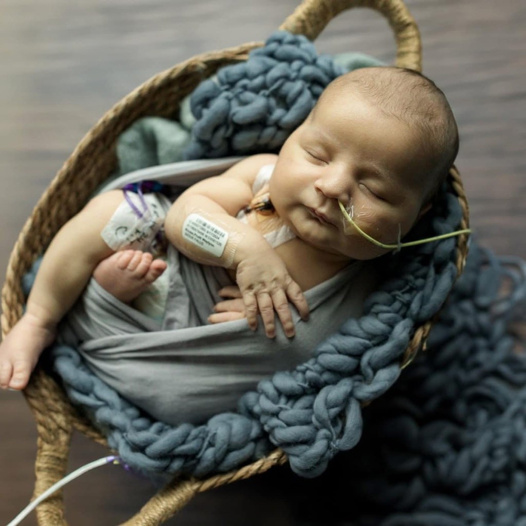 “Think Rare and Act Fast”: A South Dakota Family’s Mission After Losing Their Son Pruitt to OTC&nbsp;Deficiency