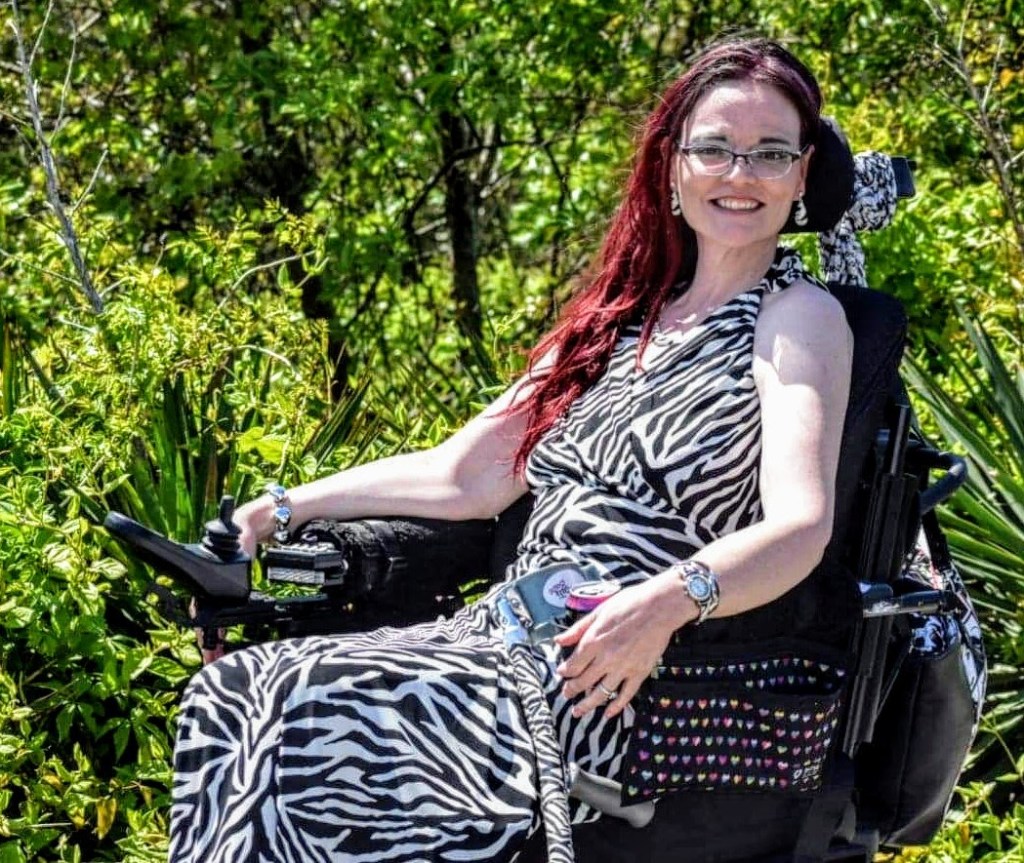 Carrie Difilippantonio, who has several rare diseases, smiles at the camera. She is sitting in her wheelchair and wearing a zebra-striped dress